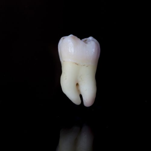 Chirurgia stomatologiczna -Usuwanie zębów