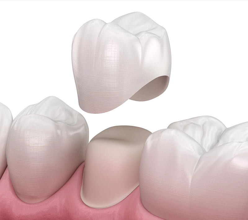 Korony zębowe Poznań