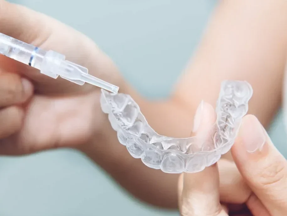 wybielanie-nakladkowe-rdent-poznan-e1732546776215